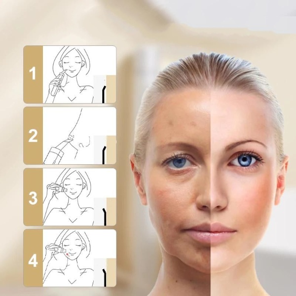 Appareil massage visage ultrasons dissolvant de points noirs image 6 5